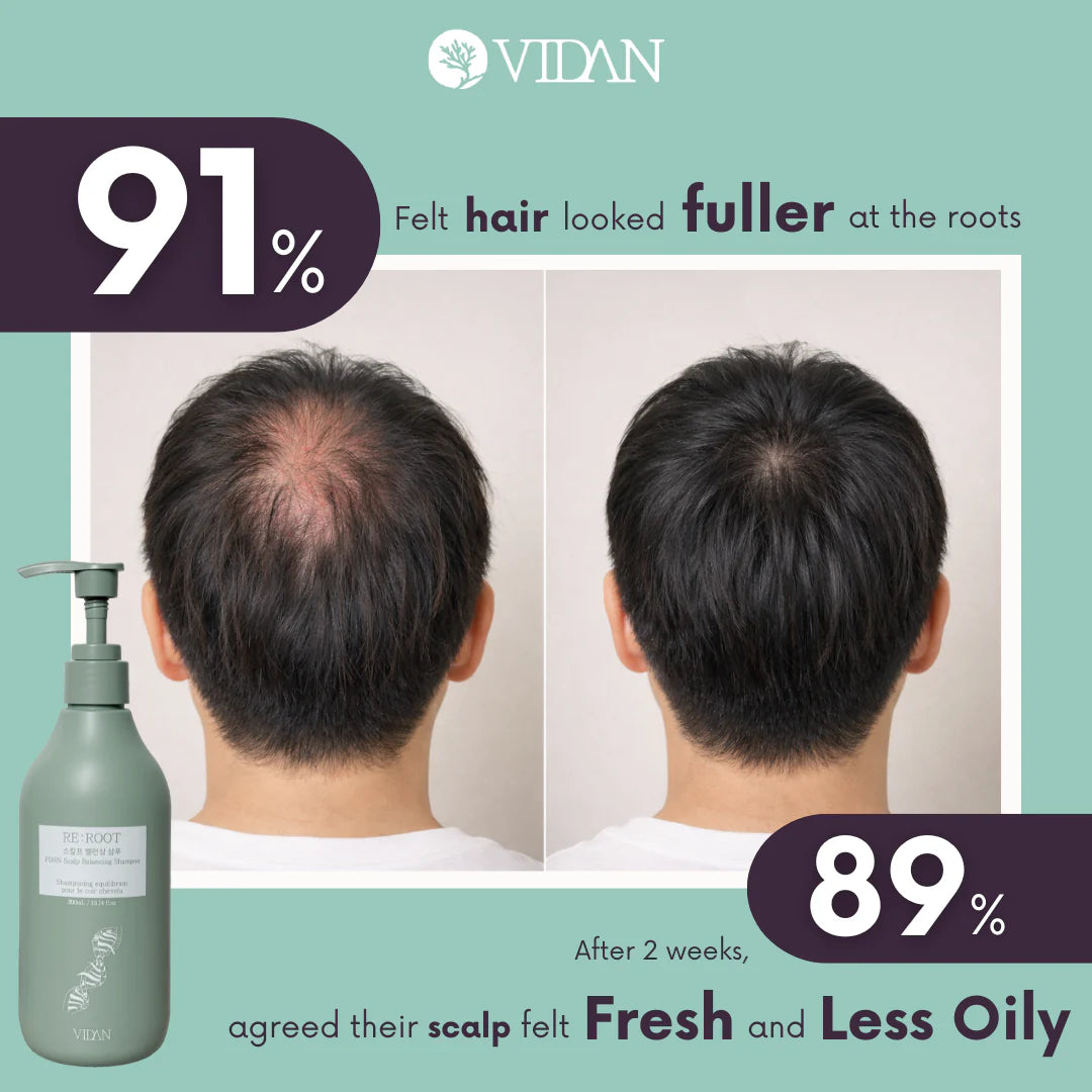 VIDAN - RE:ROOT PDRN Scalp Balancing Shampoo