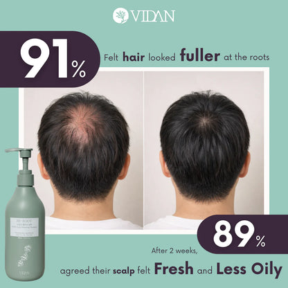 VIDAN - RE:ROOT PDRN Scalp Balancing Shampoo